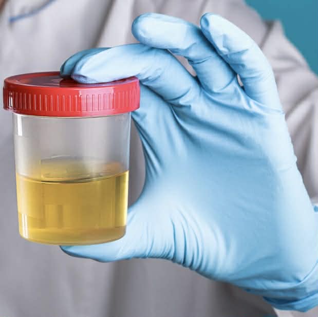 Rapid Drug Test